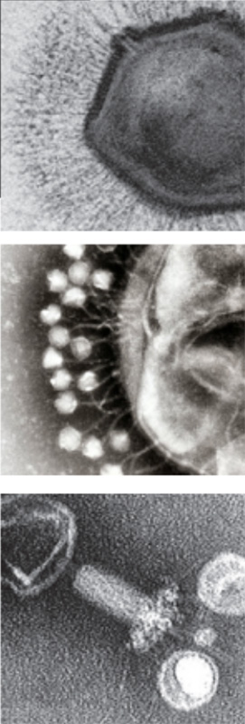 Microscopy images of several different kinds of marine viruses